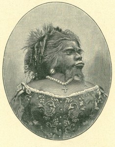 Julia Pastrana the Mexican bearded woman (1834-1860). She suffered from congenital hirsutism combined with gingival hyperplasia. Displayed in the US as a circus attraction and the result of union between a woman and a bear, her manager made her pregnant a