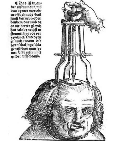 trepanning